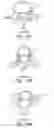 Fig. 13 - System and methods for improved access to vertebral bodies for kyphoplasty, vertebroplasty, vertebral body biopsy or screw placement