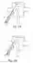 Fig. 14 - System and methods for improved access to vertebral bodies for kyphoplasty, vertebroplasty, vertebral body biopsy or screw placement