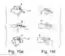 Fig. 17 - System and methods for improved access to vertebral bodies for kyphoplasty, vertebroplasty, vertebral body biopsy or screw placement