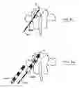 Fig. 30 - System and methods for improved access to vertebral bodies for kyphoplasty, vertebroplasty, vertebral body biopsy or screw placement
