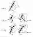 Fig. 33 - System and methods for improved access to vertebral bodies for kyphoplasty, vertebroplasty, vertebral body biopsy or screw placement