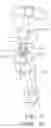 Fig. 07 - Physical rehabilitation device
