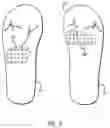 Fig. 06 - Therapeutic light treatment devices and methods
