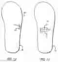 Fig. 08 - Therapeutic light treatment devices and methods