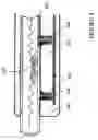 Fig. 06 - Implantable anti-clogging device for maintenance of cerebrospinal fluid shunt patency