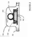 Fig. 07 - Implantable anti-clogging device for maintenance of cerebrospinal fluid shunt patency