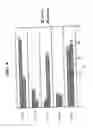 Fig. 05 - Method of treating skin ulcers using oxidative reductive potential water solution