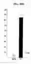 Fig. 14 - Method of treating skin ulcers using oxidative reductive potential water solution