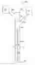 Fig. 01 - Gastric tube and method for introducing the same