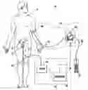 Fig. 01 - Patient hydration system with abnormal condition sensing
