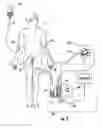 Fig. 03 - Patient hydration system with abnormal condition sensing