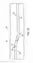 Fig. 03 - Method of evaluating a treatment for vascular disease
