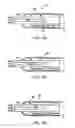 Fig. 16 - Method of evaluating a treatment for vascular disease
