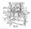 Fig. 03 - Facilitating tools for cardiac tissue ablation