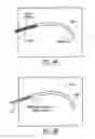 Fig. 08 - Facilitating tools for cardiac tissue ablation