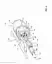 Fig. 05 - Electrosurgical tool