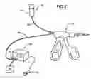 Fig. 02 - Fluid-assisted electrosurgical scissors and methods