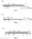 Fig. 02 - Vacuum coagulation probes