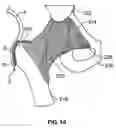 Fig. 12 - Vacuum coagulation probes