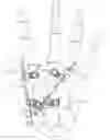 Fig. 01 - External fixator