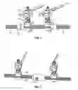 Fig. 02 - External fixator