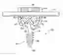 Fig. 01 - Low profile polyaxial screw