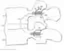 Fig. 01 - Pedicular tunneling for decompression and support