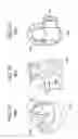 Fig. 09 - Spinal stabilization using bone anchor and anchor seat with tangential locking feature