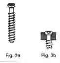 Fig. 06 - Method for the correction of spinal deformities using a rod-plate anterior system