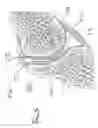 Fig. 06 - Facet joint stabilization