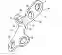 Fig. 01 - Fixation device for the talus