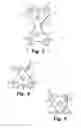 Fig. 03 - Fixation device for the talus