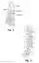 Fig. 02 - Navicular fixation device