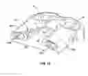 Fig. 10 - Ratcheting fixation plate
