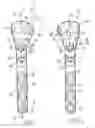 Fig. 04 - Device for the ostheosynthesis of proximal humerus fractures