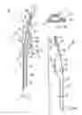 Fig. 05 - Device for the ostheosynthesis of proximal humerus fractures