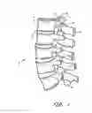 Fig. 02 - Flanged interbody fusion device with locking plate
