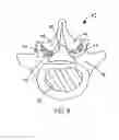 Fig. 05 - Flanged interbody fusion device with locking plate