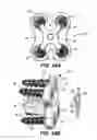 Fig. 30 - Flanged interbody fusion device with locking plate