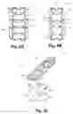 Fig. 11 - Active compression orthopedic plate system and method for using the same