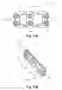 Fig. 14 - Active compression orthopedic plate system and method for using the same