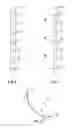 Fig. 03 - Method for treating long bone fractures