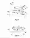 Fig. 06 - Apparatus and methods for bone fracture fixation