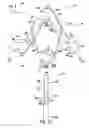 Fig. 08 - Apparatus and methods for bone fracture fixation