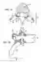 Fig. 03 - Flanged interbody fusion device