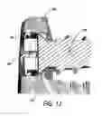 Fig. 13 - Flanged interbody fusion device