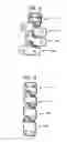 Fig. 18 - Flanged interbody fusion device