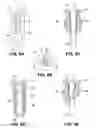 Fig. 06 - Surgical expansion fasteners