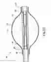 Fig. 07 - Devices, kit and method for kyphoplasty