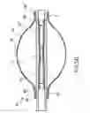 Fig. 08 - Devices, kit and method for kyphoplasty